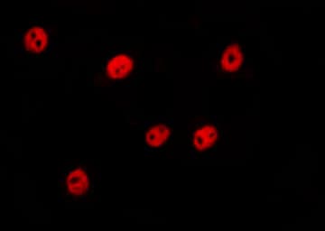 Polyclonal Rabbit anti-Human MLF1 Antibody (IF, WB)