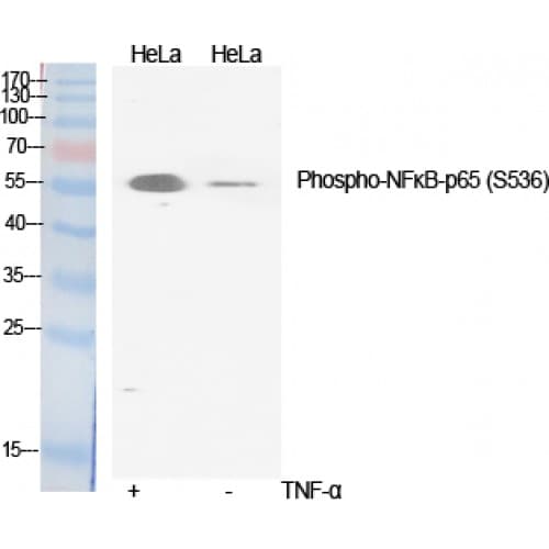 RELA / NFKB p65 Antibody (470-550 aa)