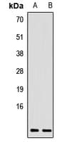 CCL17 / TARC Antibody