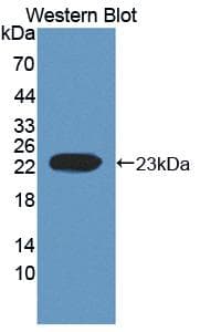 EFNA1 / Ephrin A1 Antibody (aa19-182)