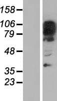 ZNF512B Protein (Over-Expression Lysate Myc-DDK (Flag))