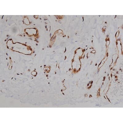 MAPT / Tau Antibody (phospho-Ser396)