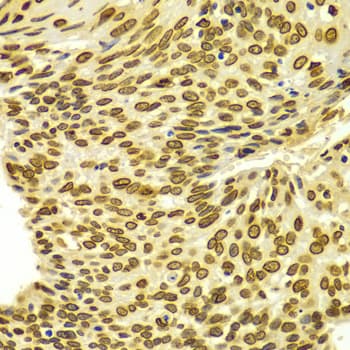LMNA / Lamin A+C Antibody