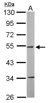 IHC-plus™ NDUFV1 Antibody (aa218-459)