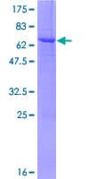 Human MGLL / Monoacylglycerol Lipase Protein (Recombinant GST)