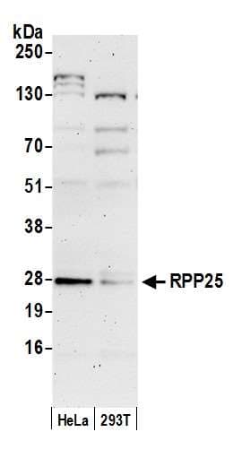 Polyclonal Rabbit anti-Human RPP25 Antibody (aa149-199, WB)