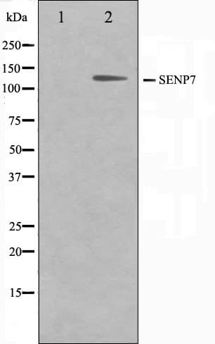 Polyclonal Rabbit anti-Human SENP7 Antibody (IHC, IF, WB)