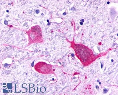 PathPlus™ P2RY8 / P2Y8 Antibody (C-Terminus)
