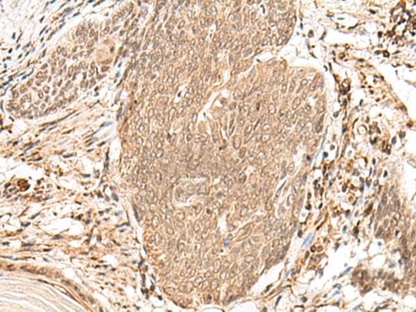 CCDC132 Antibody