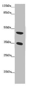 FAM46C Antibody