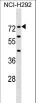 Polyclonal Rabbit anti-Human F12 / Factor XII Antibody (aa9-38, WB)