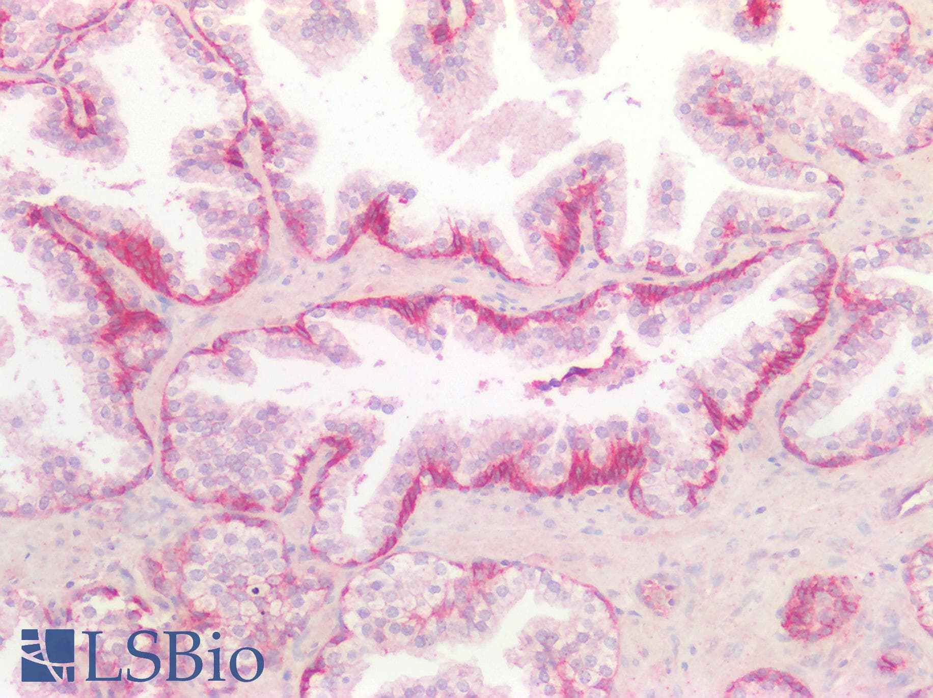 IHC-plus™ Polyclonal Rabbit anti-Human SDC1 / Syndecan 1 / CD138 Antibody (aa23-254, IHC, IF)