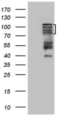 HIPK1 Antibody (aa439-697, clone OTI5F1)