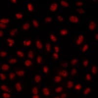 WDR11 / PHIP Antibody