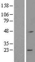 Human RNF183 Protein (Over-Expression Lysate Myc-DDK (Flag))