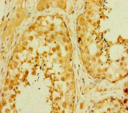 SMAD2 Antibody