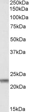 IHC-plus™ CLDN14 / Claudin 14 Antibody (aa227-239)