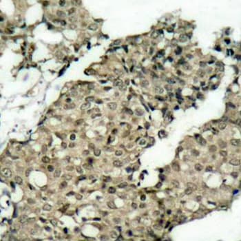 Polyclonal Rabbit anti-Human G3BP1 / G3BP Antibody (phospho-Ser232, IHC, IF, WB)