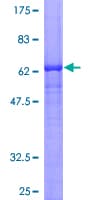 Human FSD1 Protein (Recombinant GST)