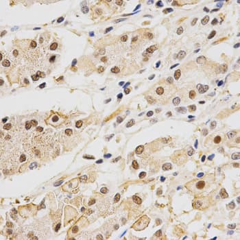 HURP / DLGAP5 Antibody