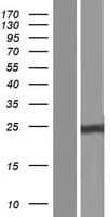 CLCF1 Protein (Over-Expression Lysate Myc-DDK (Flag))