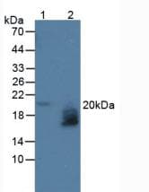 WFDC2 / HE4 Antibody (aa30-124, Cy3)