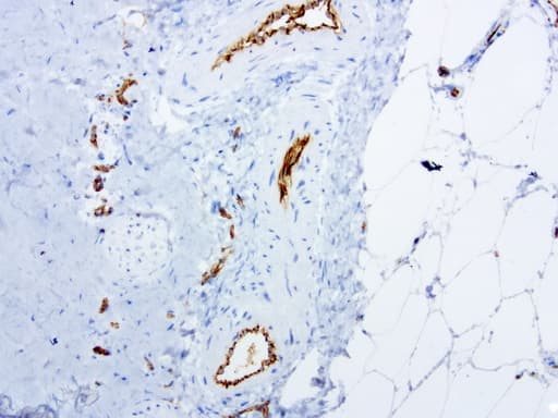 PECAM-1 / CD31 Antibody (clone UMAB164)