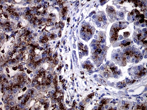 Monoclonal Mouse anti-Human CTSL / Cathepsin L Antibody (clone OTI2H2, IHC, WB)