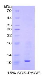 Mouse MT3 / Metallothionein 3 Protein (Recombinant His-T7)