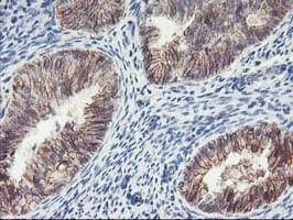 Monoclonal Mouse anti-Human ALOX15 / 15-Lipoxygenase Antibody (clone OTI3G8, IHC, IF, WB)