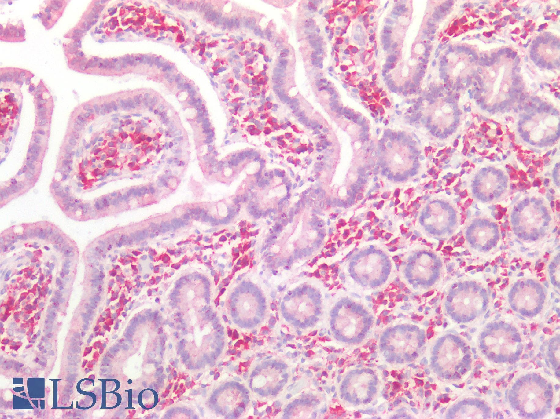 PathPlus™ TGFBR2 Antibody (aa13-40)