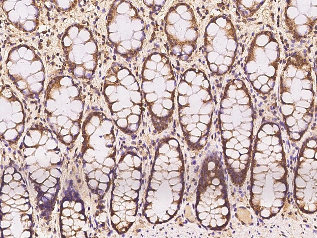 MRPL37 Antibody