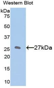 BCL2 / Bcl-2 Antibody (aa2-211)