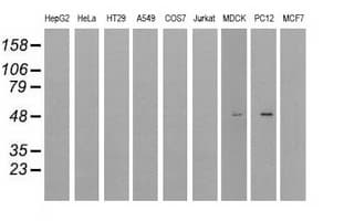 Monoclonal Mouse anti-Human LOX / Lysyl Oxidase Antibody (clone OTI5C4, IHC, IF, WB)