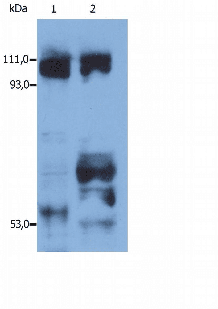 Polyclonal Rabbit anti-Human Kinesin Antibody (clone Polyclonal, aa331-906, WB)