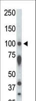 STK31 Antibody (aa32-62)