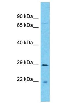 SFR1 / C10orf78 Antibody (aa177-226)