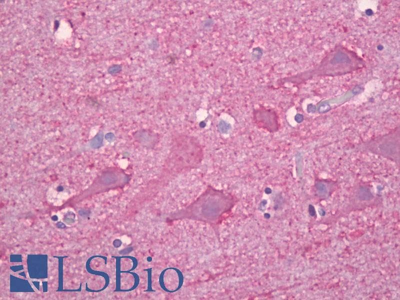 IHC-plus™ Polyclonal Rabbit anti-Human SNCG / Gamma-Synuclein Antibody (aa78-127, IHC, WB)