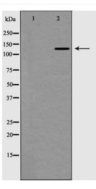 Collagen III Antibody