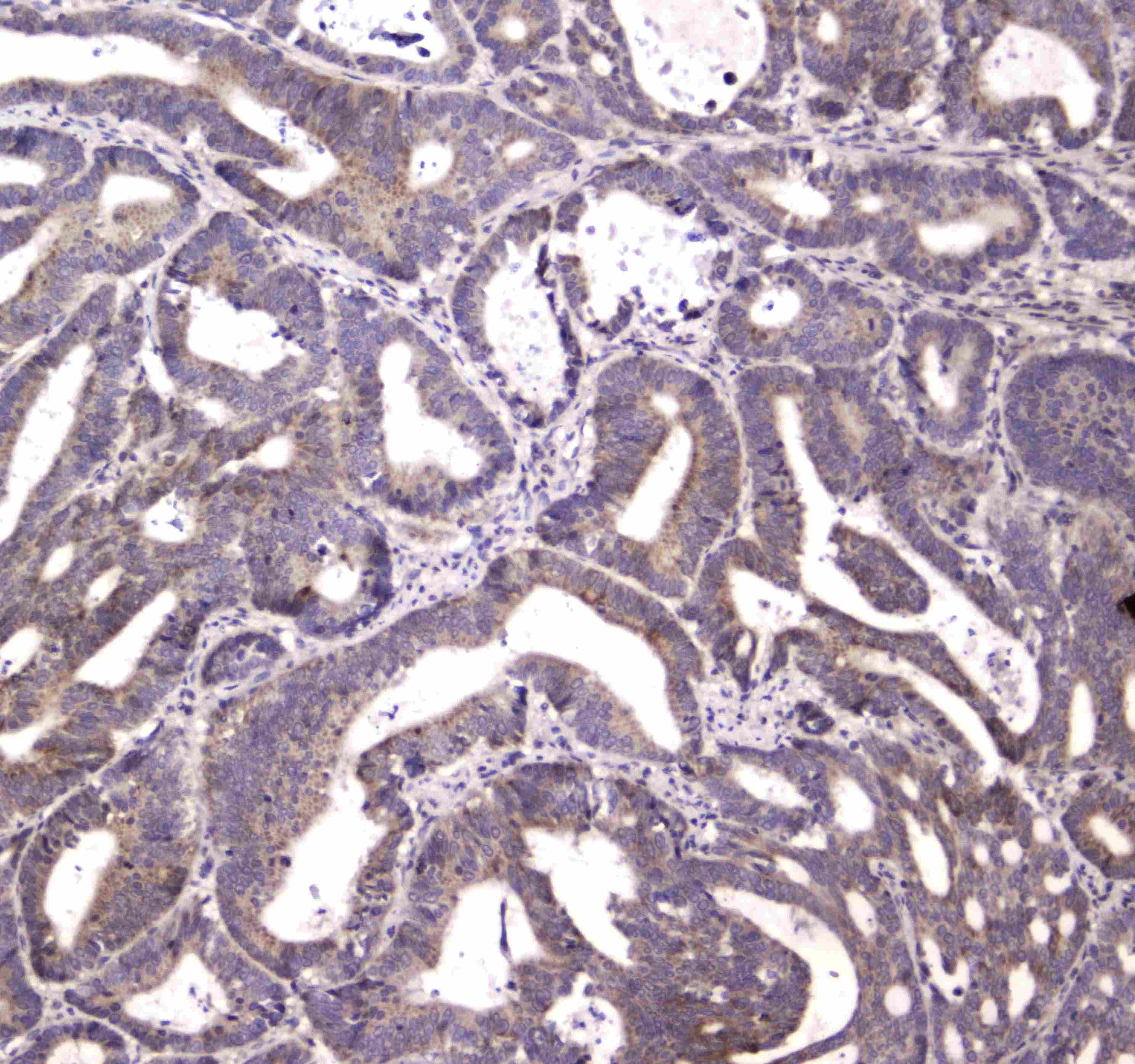 Polyclonal Rabbit anti-Human HTRA1 Antibody (IHC, WB)