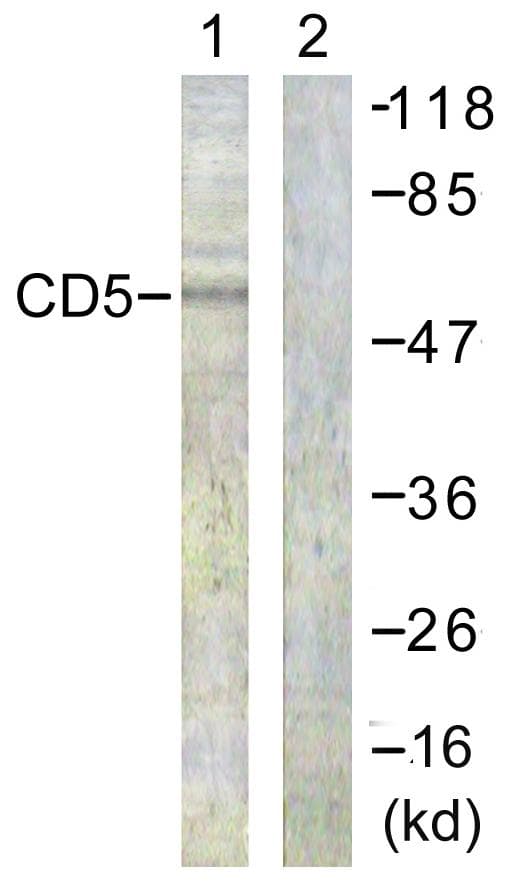 CD5 Antibody (phospho-Tyr453)