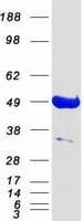 Human PACSIN3 Protein (Recombinant Myc-DDK (Flag))