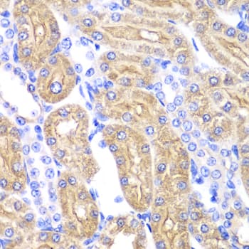 Polyclonal Rabbit anti-Human ALDH2 Antibody (IHC, IF, WB)