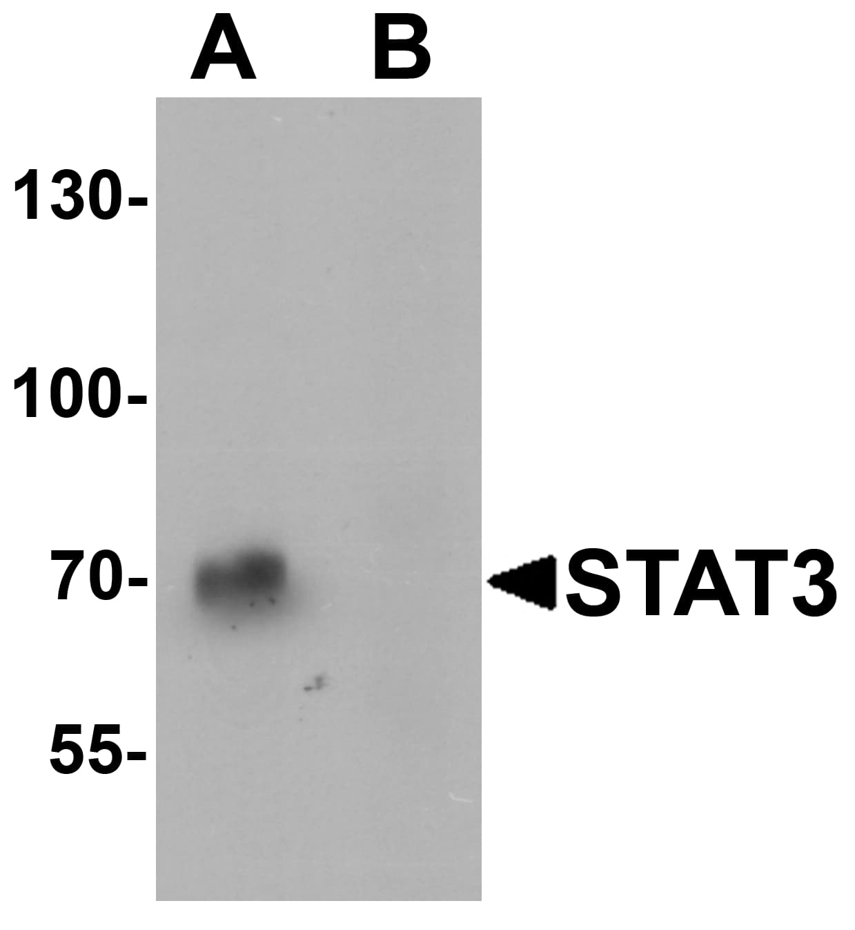 IHC-plus™ STAT3 Antibody