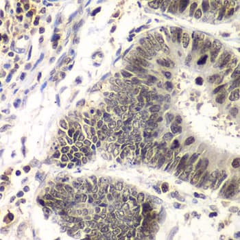 SMARCA4 / BRG1 Antibody