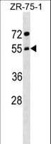 COPD / ARCN1 Antibody (aa296-324)