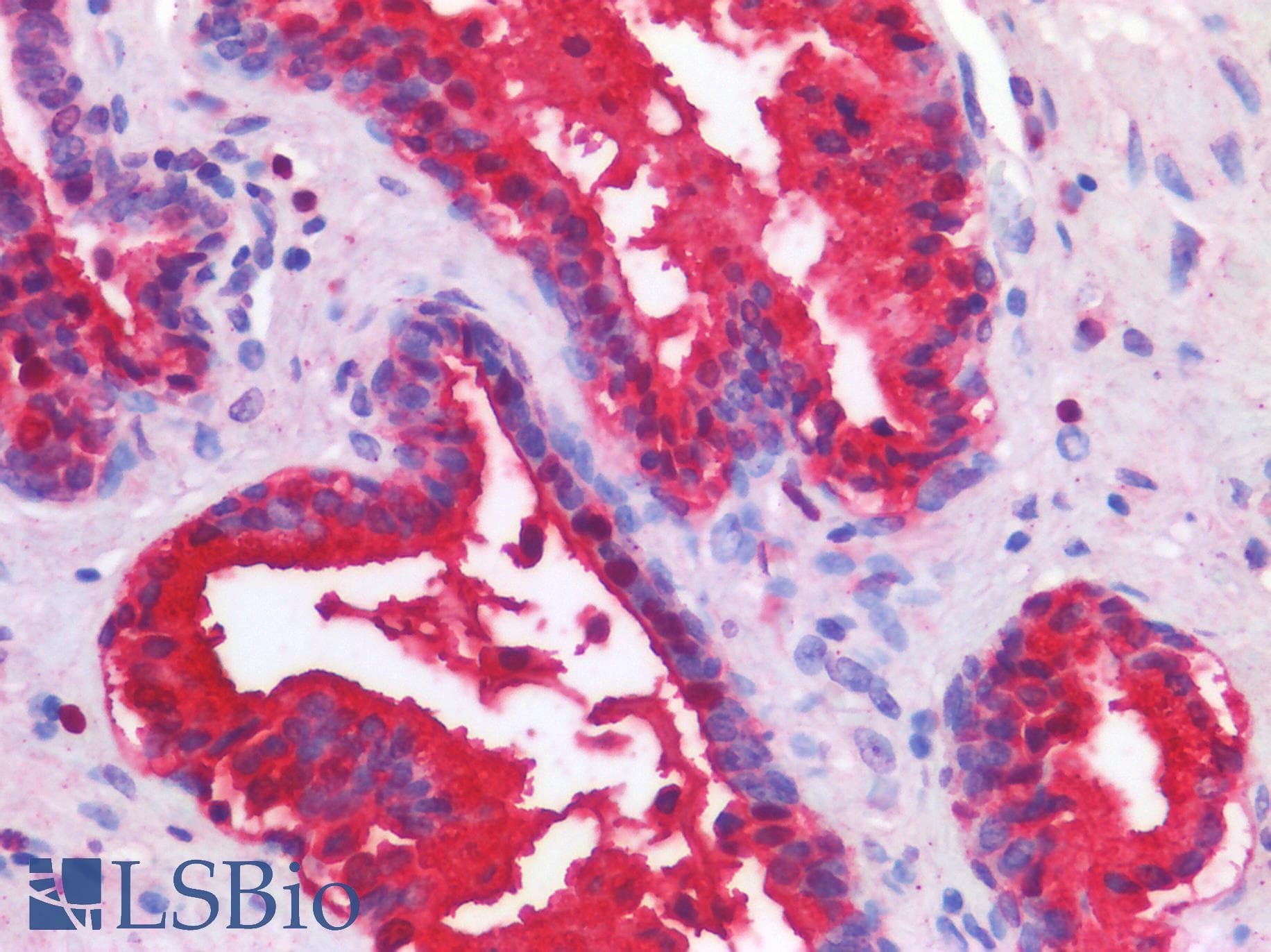 IHC-plus™ Polyclonal Rabbit anti-Human TP63 / p63 Antibody (IHC)