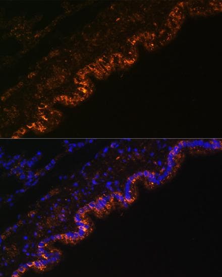 SCNN1A / ENaC Alpha Antibody