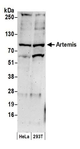 DCLRE1C / Artemis Antibody (aa650-C-term)