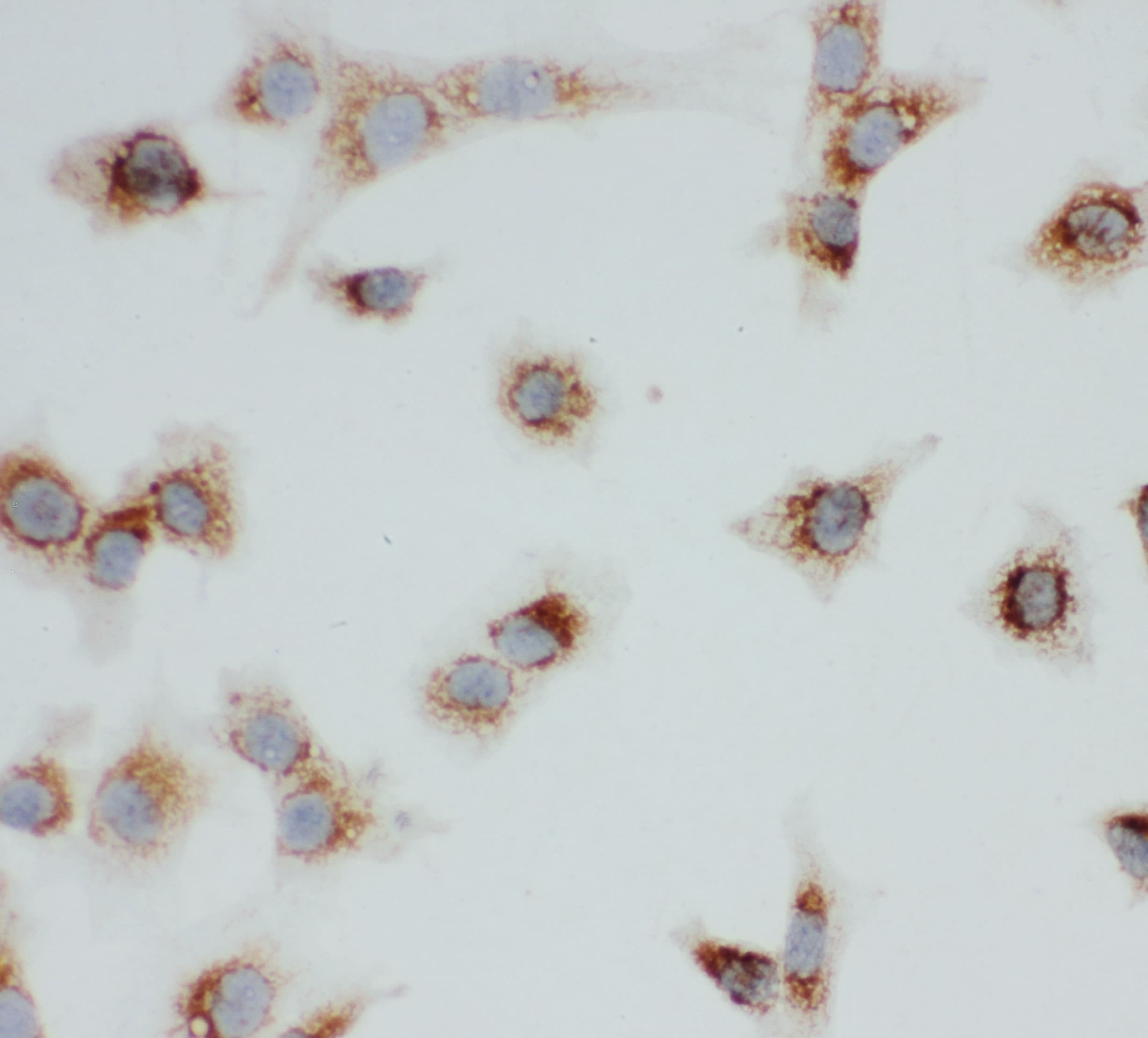 VDAC1 / PORIN Antibody (aa163-178)